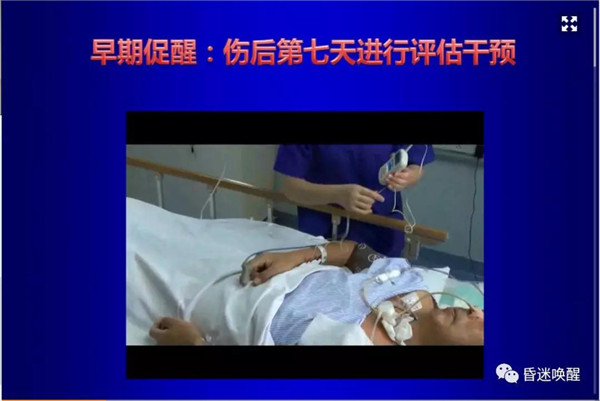 右正中电刺激|简单实用的昏迷早期促醒新技术