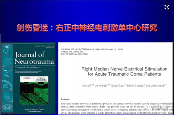 右正中电刺激|简单实用的昏迷早期促醒新技术