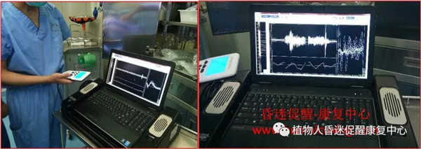 昏迷促醒 | 脑深部电刺激技术简介